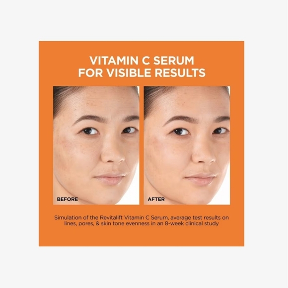 L'Oréal Revitalift C The Glow Kit - Picture 11 of 13